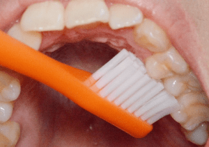 歯の内側の磨き方