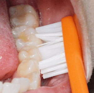 歯と歯の間の磨き方