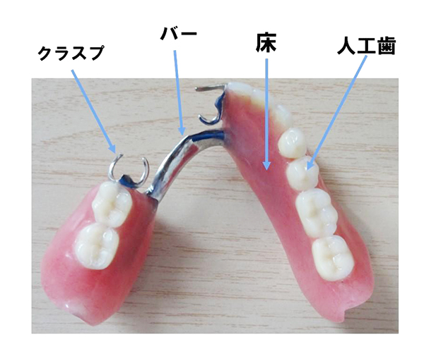 義歯（ぎし）