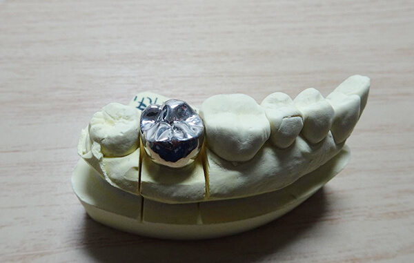 FCKの作成　ワックスで歯型を作り、それを金属に置き換えて作成