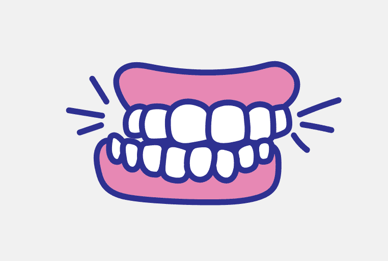 歯ぎしりとは何か？